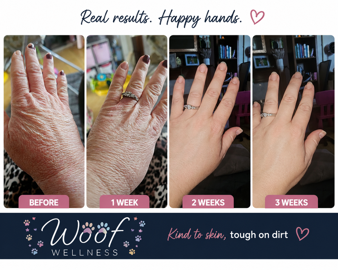 Chapped Sore Hands Review From A Customer